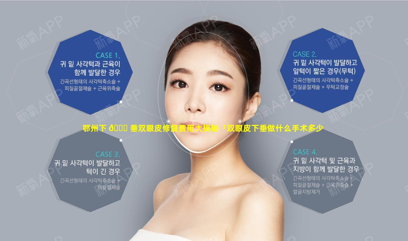 鄂州下 🐛 垂双眼皮修复费用大揭秘「双眼皮下垂做什么手术多少钱」